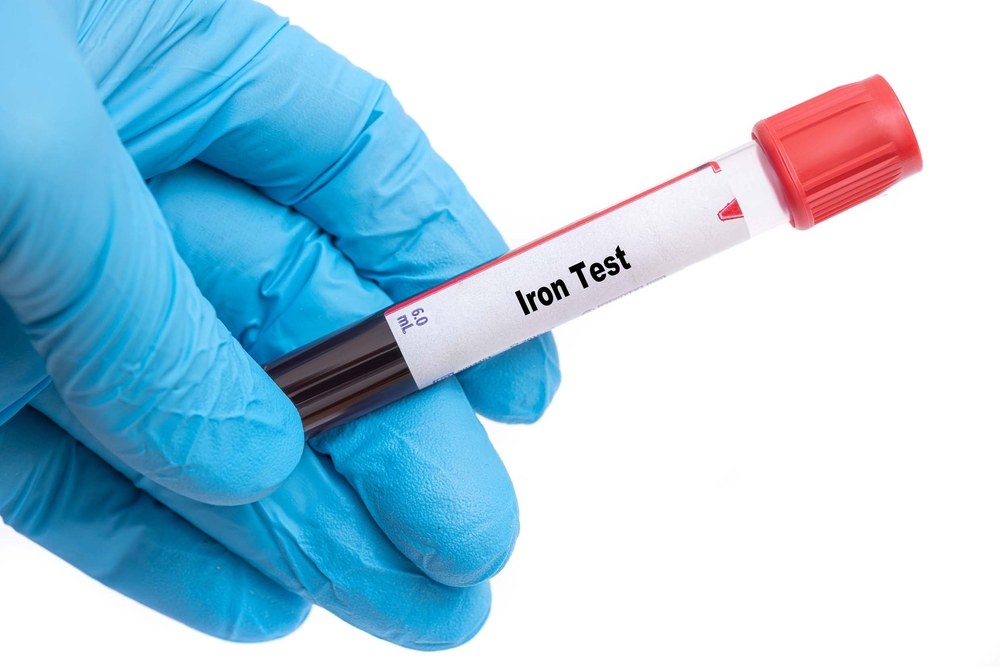 gloved hand holding blood vial labeled Iron Test